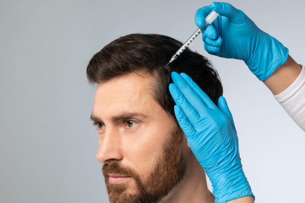 A Man getting hair treatment through PRP | Perfectly Made Aesthetic Boutique in Prosper, TX