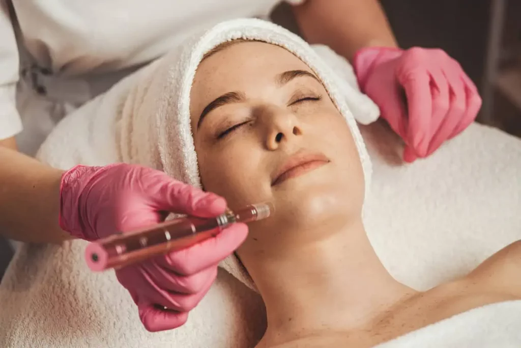 Microneedling Facials by Perfectly Made Aesthetic Boutique in Prospar TX